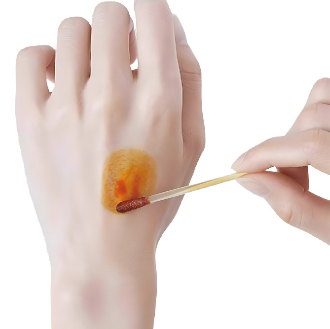 ポビドンョ一ド 消毒綿棒10w/v%